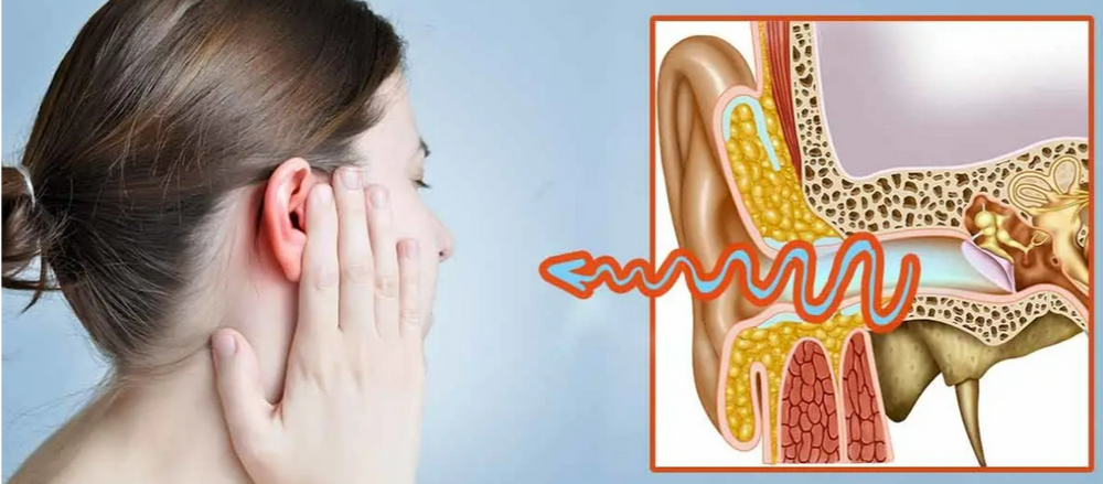 Water Stuck in Ear for Days? Here’s What You Really Need to Know